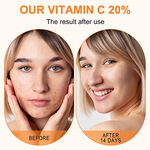 Hyaluronik Asit, Retinol ve Amino Asitler içeren Yüz için Premium %20 C Vitamini Serumu - Cilt Kollajenini Artırın,